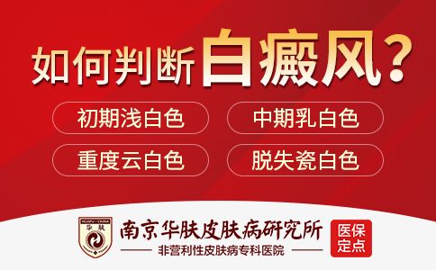 南京白癜风医院找华肤“专家在线预约”白癜风一般多久扩散？