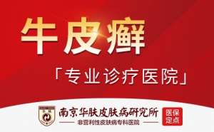 南京华肤牛皮癣专家门诊诊疗成果展示